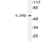 Bs1759_wb