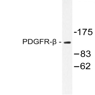 PDGFR-(beta) (G1017) pAb