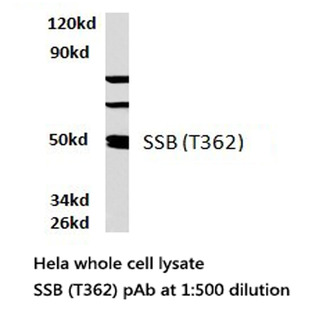 SSB (T362) pAb