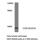 VDR (N204) pAb