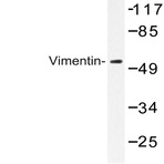 Vimentin (L52) pAb