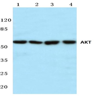 AKT (P470) pAb