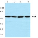 AKT (P470) pAb