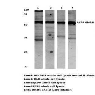 LKB1 (R425) pAb