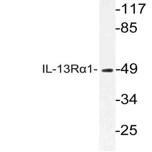 IL-13R(alpha)1 (K401) pAb