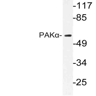 PAK1 (E195) pAb