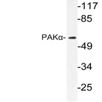 PAK1 (E195) pAb