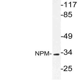 NPM (K230) pAb