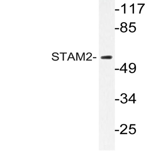 STAM2 (T188) pAb