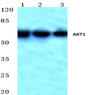 AKT1 (M118) pAb