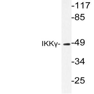 IKK(gamma) (D25) pAb