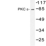 PKC E (F725) pAb