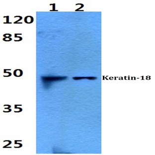 Cytokeratin 18 (S48) pAb