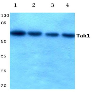 Tak1 (D181) pAb