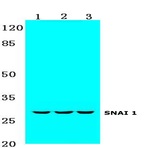 SNAI 1 (A242) pAb