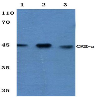 Casein Kinase II(alpha) (T251) pAb