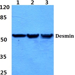 Desmin (V56) pAb