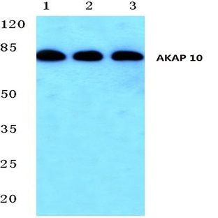 AKAP 10 (R27) pAb