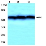 AIRE (P126) pAb