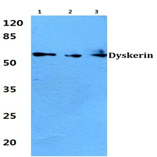 Dyskerin (K203) pAb