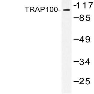 TRAP100 (K834) pAb