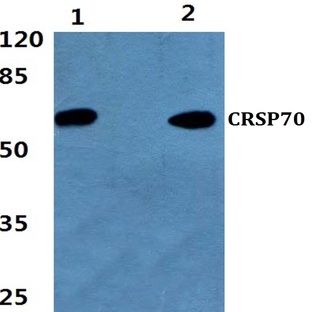 CRSP70 (S7) pAb