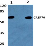 CRSP70 (S7) pAb