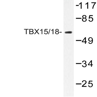 TBX15/18 (D164) pAb