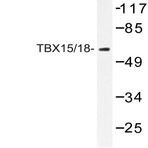 TBX15/18 (D164) pAb