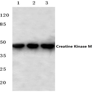 Creatine Kinase M (Y14) pAb