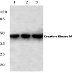 Creatine Kinase M (Y14) pAb