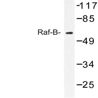 Raf-B (Y198) pAb