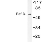 Raf-B (Y198) pAb