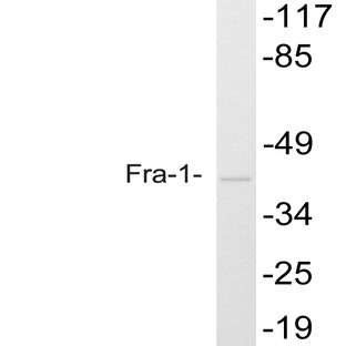 Fra-1 (D134) pAb