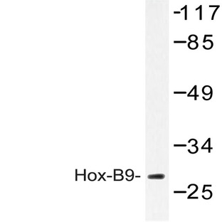 Hox-B9 (R237) pAb