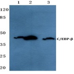 C/EBP-(beta) (V259) pAb