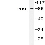 PFKL (E724) pAb