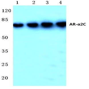 AR-(alpha)2C (R369) pAb