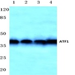 ATF1 (T209) pAb