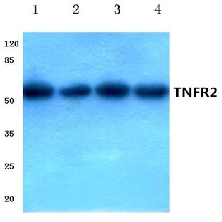 TNF-R2 (P412) pAb