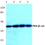 PKA(beta) cat (D324) pAb