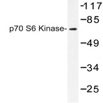 p70 S6K (T294) pAb