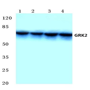 GRK 2 (D635) pAb