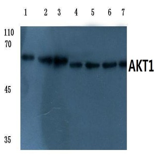 AKT1 (E40) pAb