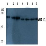 AKT1 (E40) pAb