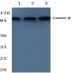 Catenin-(beta) (F660) pAb