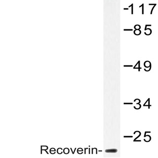 Recoverin (D143) pAb