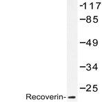 Recoverin (D143) pAb