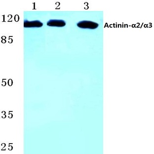 Actinin-(alpha)2/3 (Q58) pAb