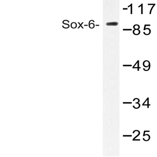 Sox6 (D23) pAb